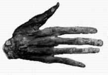 Hand of Glory